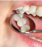 התרופפות שיניים - תמונת אווירה